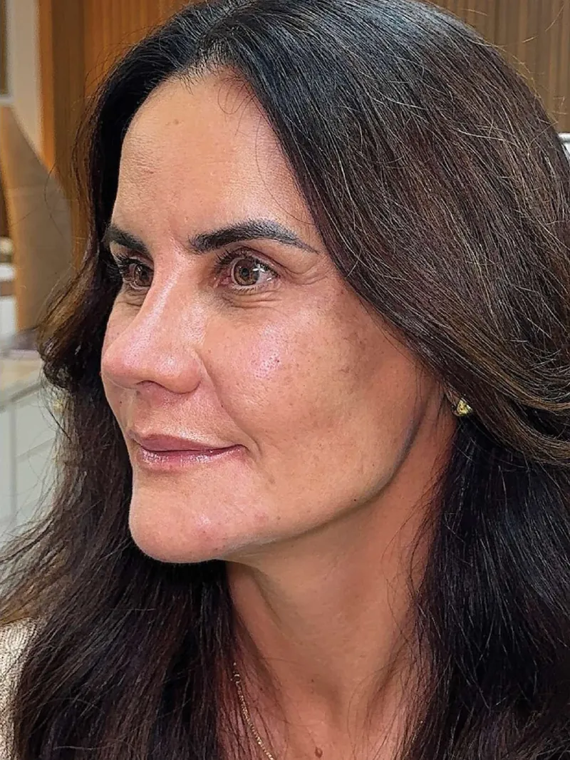Paciente depois do tratamento